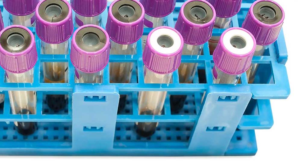 flow cytometry sample tubes in blue sample storage rack