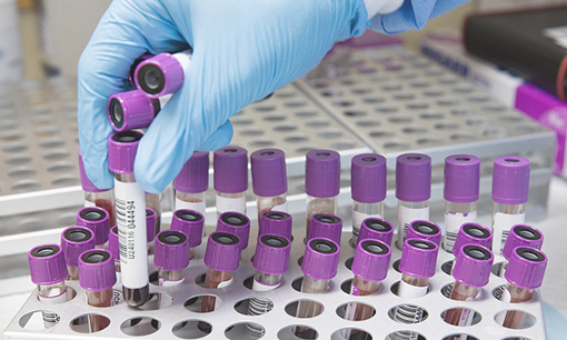 Clinical Sample Management – 4 Essential Questions for Better Tracking & Compliance in the Lab
