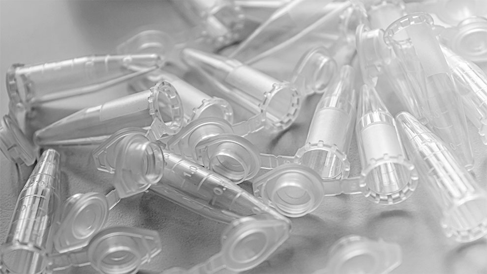 microcentrifuge sample tubes scattered over stainless steel counter