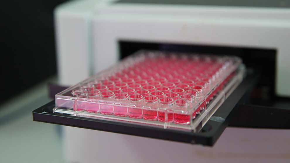 Assay Data Management 101: Spreadsheets to Scalable Systems